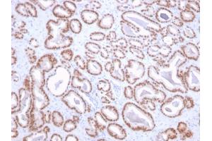 Formalin-fixed, paraffin-embedded human prostate stained with NKX3. (NKX3-1 抗体  (AA 92-224))
