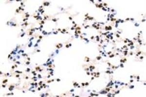 Immunohistochemistry analysis of paraffin-embedded mouse lung using BAAT1 (ABIN7073502) at dilution of 1: 1000 (BAAT1 抗体)
