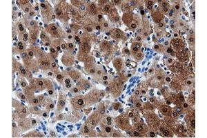 Image no. 4 for anti-Adenylate Kinase 5 (AK5) antibody (ABIN1496535) (Adenylate Kinase 5 抗体)