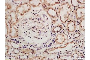 Formalin-fixed and paraffin embedded human kidney tissue labeled with Rabbit Anti-IRF9 Polyclonal Antibody, Unconjugated (ABIN2177064) at 1:200 followed by conjugation to the secondary antibody and DAB staining (IRF9 抗体  (AA 101-200))