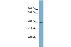 WB Suggested Anti-ASPHD2 Antibody Titration: 0. (ASPHD2 抗体  (Middle Region))