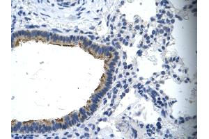 Human Lung; . (Asialoglycoprotein Receptor 2 抗体  (N-Term))