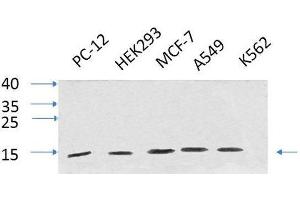 Western Blot analysis of various cells using IL8 Polyclonal Antibody at dilution of 1:1000. (IL-8 抗体)