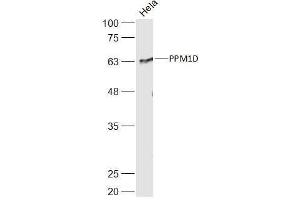 Hela lysates probed with PPM1D Polyclonal Antibody, Unconjugated  at 1:500 dilution and 4˚C overnight incubation. (PPM1D 抗体  (AA 201-300))