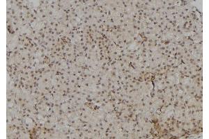 ABIN6264342 and ABIN6277090 at 1/100 staining Rat kidney tissue by IHC-P. (POLR2A/RPB1 抗体  (Internal Region))