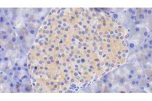 Detection of TF in Mouse Pancreas Tissue using Monoclonal Antibody to Tissue Factor (TF)