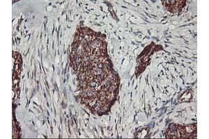 Immunohistochemistry (IHC) image for anti-TNF Receptor-Associated Protein 1 (TRAP1) antibody (ABIN1501499)