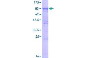 Image no. 1 for Transforming Growth Factor, beta Receptor II (70/80kDa) (TGFBR2) (AA 1-567) protein (GST tag) (ABIN1322613)