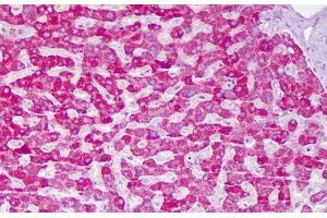 Anti-ACAT1 antibody IHC staining of human liver, hepatocytes. (ACAT1 抗体  (AA 221-270))