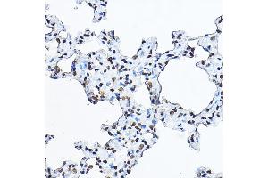 Immunohistochemistry (IHC) image for anti-Histone 3 (H3) (C-Term) antibody (ABIN3023243)