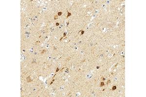 IHC analysis of LC3A/MAP1LC3A using anti-LC3A/MAP1LC3A antibody (ABIN5693061). (MAP1LC3A 抗体  (AA 1-120))