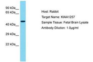 Image no. 1 for anti-Cilia and Flagella Associated Protein 92 (CFAP92) (AA 314-363) antibody (ABIN6750571) (CFAP92/KIAA1257 抗体  (AA 314-363))