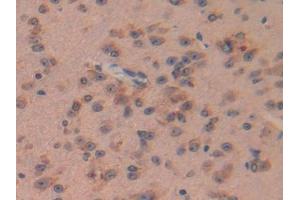 IHC-P analysis of Mouse Brain Tissue, with DAB staining. (PACAP 抗体  (AA 1-175))