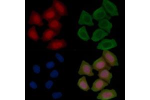 Phospho-Optineurin (Ser177) Antibody staining Hela cells(45 min of heat-shock treatment) by IF/ICC.