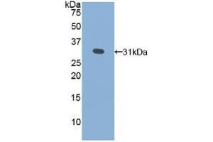 Detection of Recombinant GLa, Human using Polyclonal Antibody to Galactosidase Alpha (GLa) (GLA 抗体  (AA 147-371))