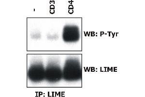 Induction of LIME tyrosine phosphorylation. (LIME 抗体  (AA 141-295))