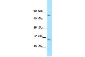 WB Suggested Anti-DAZAP2 Antibody Titration: 1. (DAZAP2 抗体  (C-Term))