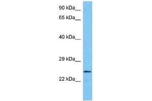 Host:  Mouse  Target Name:  MXI1  Sample Tissue:  Mouse Brain  Antibody Dilution:  1ug/ml (MXI1 抗体  (Middle Region))
