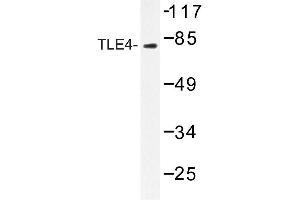Image no. 1 for anti-Transducin-like Enhancer Protein 4 (TLE4) antibody (ABIN272213) (TLE4 抗体)
