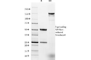 SDS-PAGE Analysis Purified EpCAM Mouse Monoclonal Antibody (EGP40/1384).