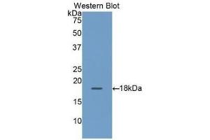 Detection of Recombinant RBP2, Human using Polyclonal Antibody to Retinol Binding Protein 2, Cellular (RBP2) (RBP2 抗体  (AA 1-134))