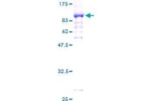 Image no. 1 for PDZ and LIM Domain 5 (PDLIM5) (AA 1-596) protein (GST tag) (ABIN1314570) (PDLIM5 Protein (AA 1-596) (GST tag))