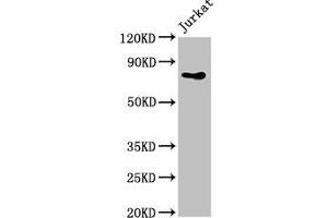 Western Blot Positive WB detected in: Jurkat whole cell lysate All lanes: PIK3R2 antibody at 4 μg/mL Secondary Goat polyclonal to rabbit IgG at 1/50000 dilution Predicted band size: 82 kDa Observed band size: 82 kDa (PIK3R2 抗体  (Regulatory Subunit beta))