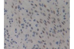 Immunohistochemistry (IHC) image for anti-High Mobility Group Nucleosome Binding Domain 1 (HMGN1) (AA 1-96) antibody (ABIN7442117)