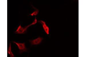 ABIN6266462 staining 293 by IF/ICC. (RIPK2 抗体  (pSer176))