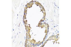 Immunohistochemistry of paraffin-embedded human prostate using SMAD2 antibody (ABIN4905224) at dilution of 1:100 (40x lens). (SMAD2 抗体)