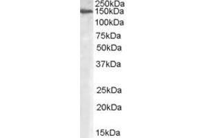 Western Blotting (WB) image for anti-MAN2A1 / Mannosidase II (AA 881-891) antibody (ABIN291737) (MAN2A1 / Mannosidase II (AA 881-891) 抗体)