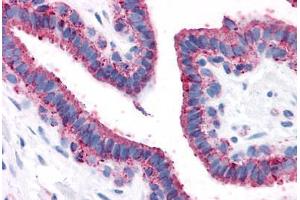 Immunohistochemistry (IHC) image for anti-G Protein-Coupled Receptor, Family C, Group 5, Member A (GPRC5A) (Transmembrane Domain) antibody (ABIN1048909)