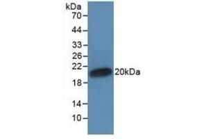 Detection of Recombinant IFNa, Human using Monoclonal Antibody to Interferon Alpha (IFNa) (IFNA 抗体  (AA 24-181))