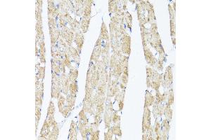 Immunohistochemistry of paraffin-embedded Rat heart using XBP1s antibody (ABIN7271399) at dilution of 1:100 (40x lens). (XBP1 抗体  (AA 300-376))