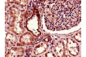 Immunohistochemistry of paraffin-embedded human kidney tissue using ABIN7172838 at dilution of 1:100 (TGFBRAP1 抗体  (AA 401-600))