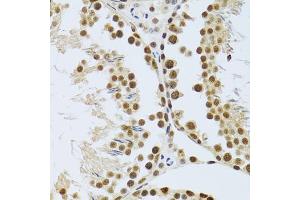 Immunohistochemistry of paraffin-embedded mouse testis using MT antibody (ABIN6128251, ABIN6144117, ABIN6144118 and ABIN6222360) at dilution of 1:100 (40x lens). (MTA3 抗体  (AA 40-330))