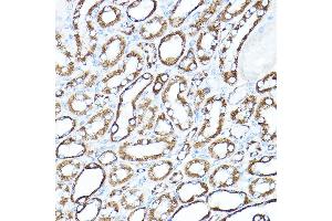Immunohistochemistry (IHC) image for anti-Hexokinase 1 (HK1) (AA 20-300) antibody (ABIN3021309)
