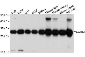 Western blot analysis of extracts of various cell lines, using ECHS1 antibody. (ECHS1 抗体  (AA 28-290))
