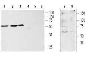 Western blot analysis of Jurkat (lanes 1 and 4), HL-60 (lanes 2 and 5), MCF-7 (lanes 3 and 6) and rat brain (lanes 7 and 8) lysates: - 1,2,3,7. (KISS1R 抗体  (3rd Extracellular Loop))
