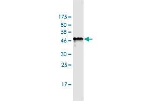 Western Blot detection against Immunogen (42. (PAGE1 抗体  (AA 1-146))
