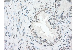 Immunohistochemical staining of paraffin-embedded Ovary tissue using anti-PLK1mouse monoclonal antibody. (PLK1 抗体)