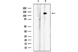 anti-MLX Interacting Protein (MLXIP) (N-Term) antibody