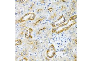 Immunohistochemistry of paraffin-embedded rat kidney using  antibody (ABIN6129960, ABIN6136680, ABIN6136681 and ABIN6224707) at dilution of 1:100 (40x lens). (AIFM3 抗体  (AA 1-200))