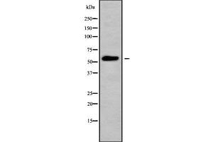 Western blot analysis of MOT6 using HepG2 whole cell lysates (SLC16A5 抗体  (Internal Region))