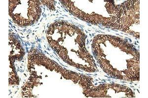 Immunohistochemical staining of paraffin-embedded Human liver tissue using anti-EPHX2 mouse monoclonal antibody. (EPHX2 抗体)