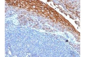 Formalin-fixed, paraffin-embedded human tonsil stained with CD146 antibody (MUC18/1130) (MCAM 抗体)