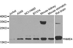Western blot analysis of extracts of various cell lines, using NME4 antibody. (NME4 抗体  (AA 1-187))