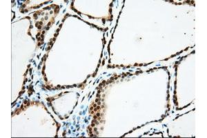 Immunohistochemical staining of paraffin-embedded Human Kidney tissue using anti-USP5 mouse monoclonal antibody. (USP5 抗体)