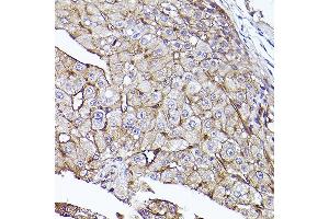 Immunohistochemistry (IHC) image for anti-5'-Nucleotidase, Ecto (CD73) (NT5E) (AA 290-550) antibody (ABIN3022734)