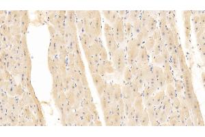 Detection of CD40L in Human Cardiac Muscle Tissue using Monoclonal Antibody to Cluster Of Differentiation 40 Ligand (CD40L) (CD40 Ligand 抗体  (AA 48-244))